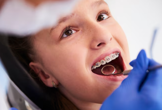 Orthodontic Care in Los Angeles Reflects Diverse Braces Treatment Options
